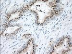 HSPA1A Antibody in Immunohistochemistry (Paraffin) (IHC (P))