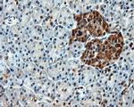 HSPA1A Antibody in Immunohistochemistry (Paraffin) (IHC (P))