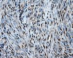 HSPA1A Antibody in Immunohistochemistry (Paraffin) (IHC (P))