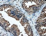 HSPA1A Antibody in Immunohistochemistry (Paraffin) (IHC (P))