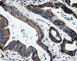 HSPA1A Antibody in Immunohistochemistry (Paraffin) (IHC (P))