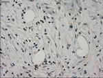 HSPA9 Antibody in Immunohistochemistry (Paraffin) (IHC (P))