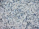 HSPA9 Antibody in Immunohistochemistry (Paraffin) (IHC (P))