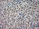 HSPA9 Antibody in Immunohistochemistry (Paraffin) (IHC (P))