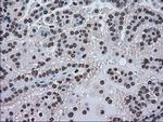 HSPA9 Antibody in Immunohistochemistry (Paraffin) (IHC (P))