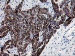 HSPBP1 Antibody in Immunohistochemistry (Paraffin) (IHC (P))