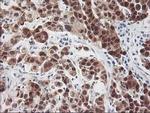 HSPBP1 Antibody in Immunohistochemistry (Paraffin) (IHC (P))