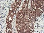 HSPBP1 Antibody in Immunohistochemistry (Paraffin) (IHC (P))