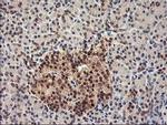 HSPBP1 Antibody in Immunohistochemistry (Paraffin) (IHC (P))