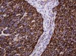 Hsp60 (HSPD1) Antibody in Immunohistochemistry (Paraffin) (IHC (P))