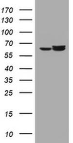 Hsp60 (HSPD1) Antibody in Western Blot (WB)