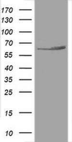 Hsp60 (HSPD1) Antibody in Western Blot (WB)