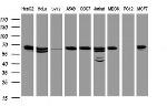 Hsp60 (HSPD1) Antibody in Western Blot (WB)