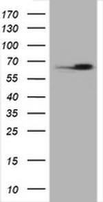 Hsp60 (HSPD1) Antibody in Western Blot (WB)