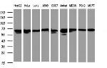 Hsp60 (HSPD1) Antibody in Western Blot (WB)