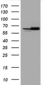 Hsp60 (HSPD1) Antibody in Western Blot (WB)