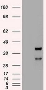 Hex Antibody in Western Blot (WB)