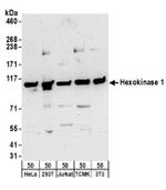Hexokinase 1 Antibody in Western Blot (WB)