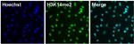 H3K14me2 Antibody in Immunocytochemistry (ICC/IF)