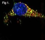 GRP94 Antibody in Immunocytochemistry (ICC/IF)