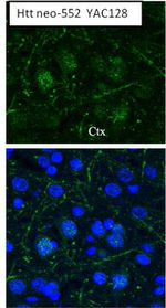 Huntingtin Antibody in Immunohistochemistry (IHC)