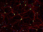 HuC/HuD Antibody in Immunocytochemistry (ICC/IF)