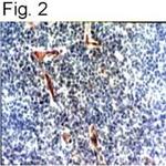 HHV-6 Envelope Antibody in Immunohistochemistry (Paraffin) (IHC (P))