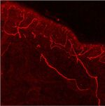 TRPV1 Antibody in Immunohistochemistry (Frozen) (IHC (F))