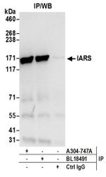 IARS Antibody in Western Blot (WB)