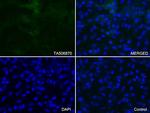 ICAM1 Antibody in Immunocytochemistry (ICC/IF)