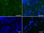 ICAM1 Antibody in Immunocytochemistry (ICC/IF)