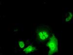 ID3 Antibody in Immunocytochemistry (ICC/IF)