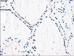 ID3 Antibody in Immunohistochemistry (Paraffin) (IHC (P))