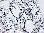 ID3 Antibody in Immunohistochemistry (Paraffin) (IHC (P))