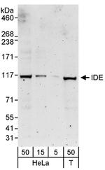 IDE Antibody in Western Blot (WB)