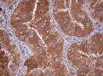 IDH1 Antibody in Immunohistochemistry (Paraffin) (IHC (P))