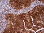 IDH1 Antibody in Immunohistochemistry (Paraffin) (IHC (P))