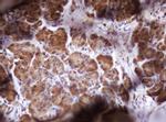 IDH1 Antibody in Immunohistochemistry (Paraffin) (IHC (P))