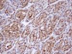 IDH1 Antibody in Immunohistochemistry (Paraffin) (IHC (P))