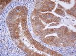 IDH1 Antibody in Immunohistochemistry (Paraffin) (IHC (P))