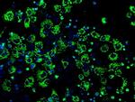 IDH3A Antibody in Immunocytochemistry (ICC/IF)