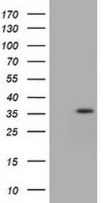 IDH3A Antibody in Western Blot (WB)