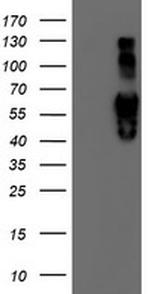 IDS Antibody in Western Blot (WB)