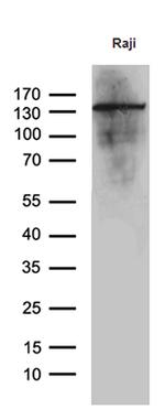 IFIH1 Antibody in Western Blot (WB)