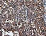 IFIT1 Antibody in Immunohistochemistry (Paraffin) (IHC (P))