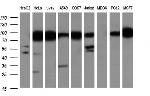 IFIT1 Antibody in Western Blot (WB)