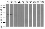 IFIT1 Antibody in Western Blot (WB)