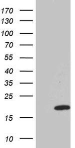 IFITM2 Antibody in Western Blot (WB)