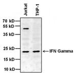 IFN gamma Antibody in Western Blot (WB)