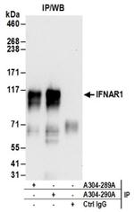 IFNAR1 Antibody in Western Blot (WB)